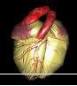 sfaturi medicale urgenta atacul cord inima nu-i glumit,nu ajunge faza avea nevoie